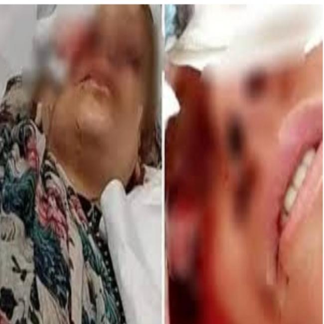 «مشان الله اتركلي عين وحدة أشوف