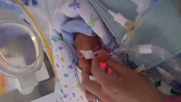 ولادة توأم بحجم عبوة مشروب غازي