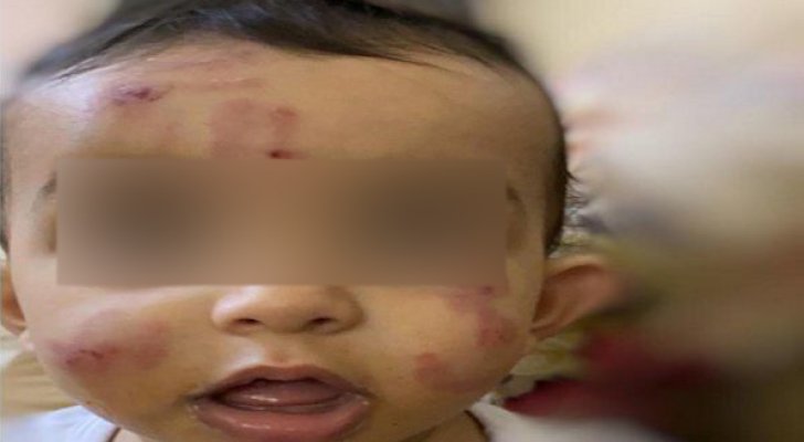رضيع يتعرض لاعتداء وحشي في السعودية..