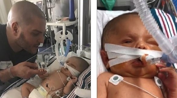 رضيع يتحدى توقعات الأطباء بعد إصابته