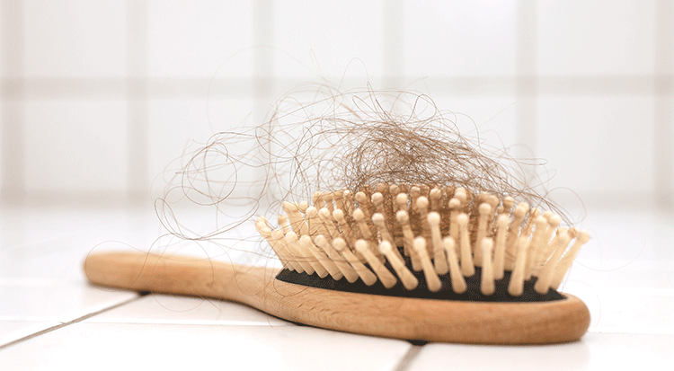 لهذا السبب يتساقط شعرك في الشتاء