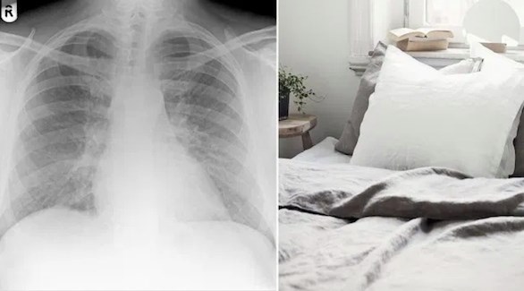 لهذا السبب تجنب استخدام لحاف محشو