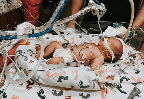 تتحدى توقعات الأطباء رغم ثقب في