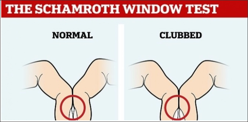 كيف تعرف من أصابعك إذا كنت