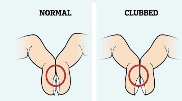 اختبار يمكنك القيام به بنفسك للكشف