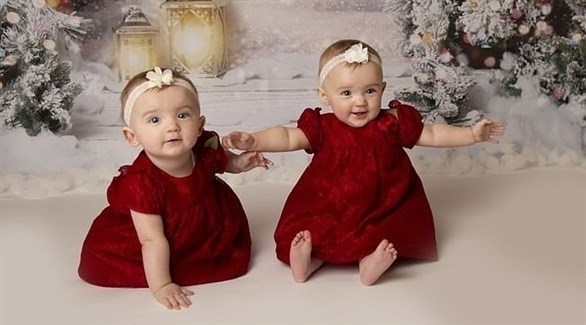 عملية بالليزر تنقذ طفلتين داخل الرحم