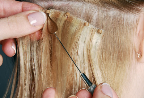 حكم زرع الشعر