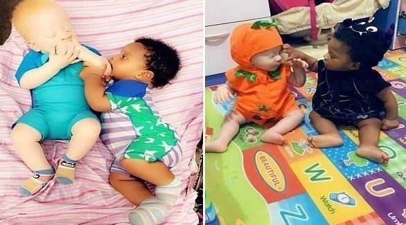 تنجب طفلين توأم.. أبيض وأسمر