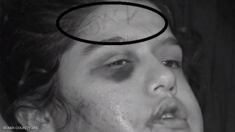 شوّه وجهها باسمه.. علاقة «فيسبوك» تؤدي