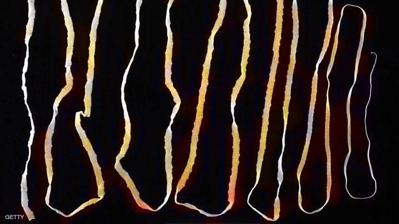 الدودة الشريطية.. كيف تعرف إذا كانت