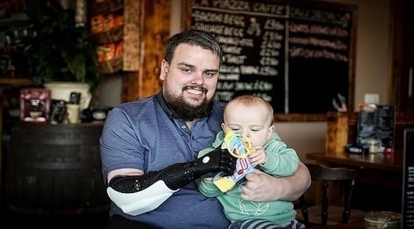 يعتني بطفله بفضل ذراع روبوتية جديدة