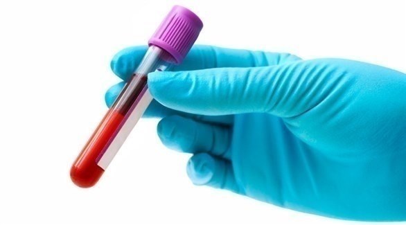 التهابات الدم مقياس مبكر لخطر الخرف