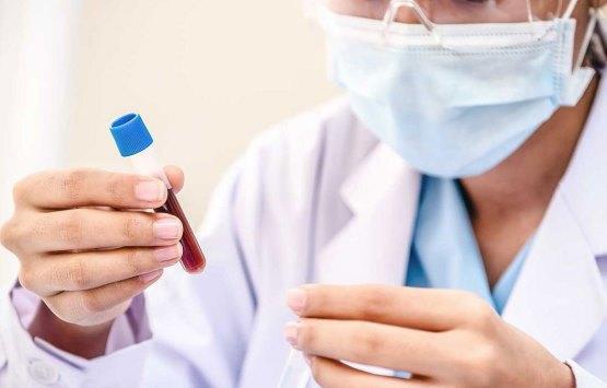 2400 وفاة بالإيدز في السودان بعام