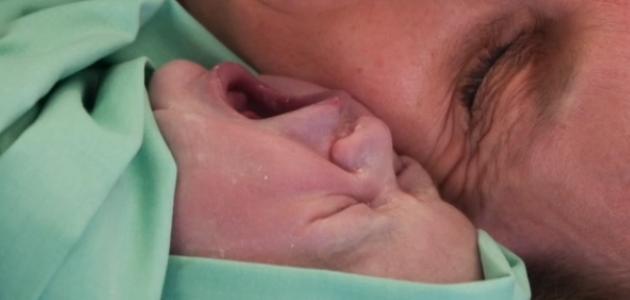 هل تزايدت العمليات القيصرية في مستشفيات