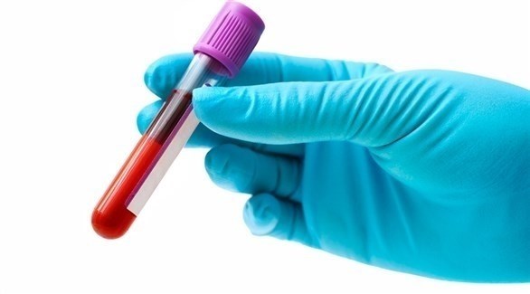 قياس الكولسترول مبكرأ أداة للتنبؤ بأمراض