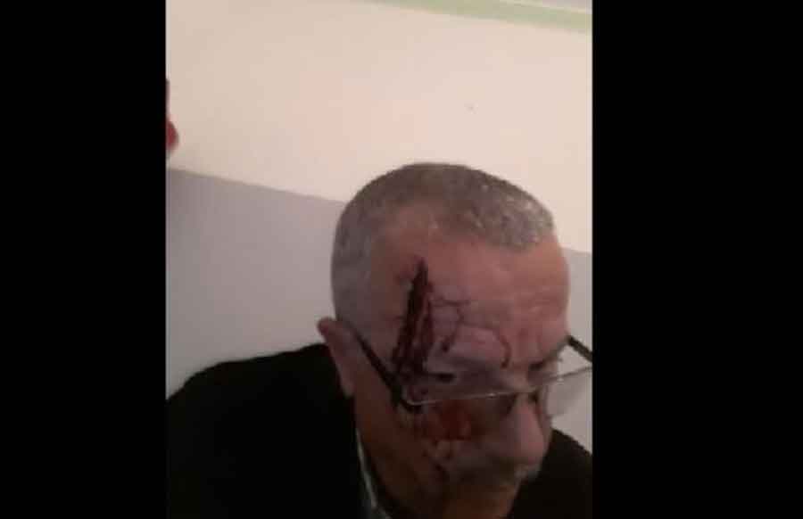 وليّ أمر يهشّم رأس مدير مدرسة