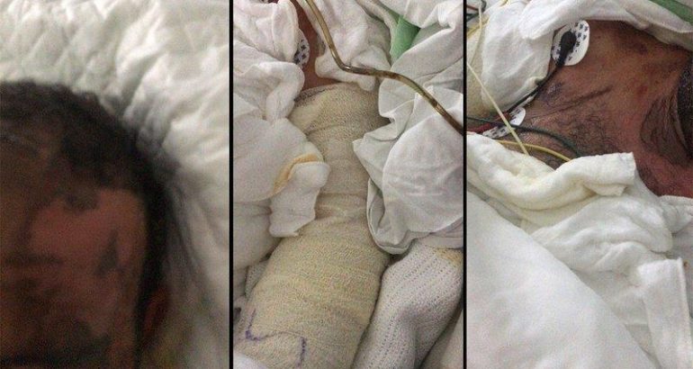 اكتشف محادثاتها مع ساحر فأحرقته بالأسيد