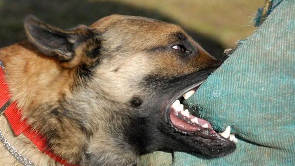 طفلة تصاب بـ «كسر في الجمجمة»