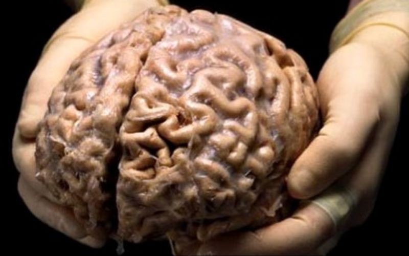 تفقد الوعي كلما ضحكت بسبب حالة