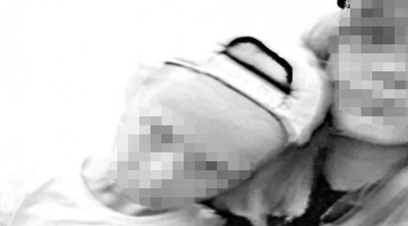 حمل طفلة من طفل في روسيا