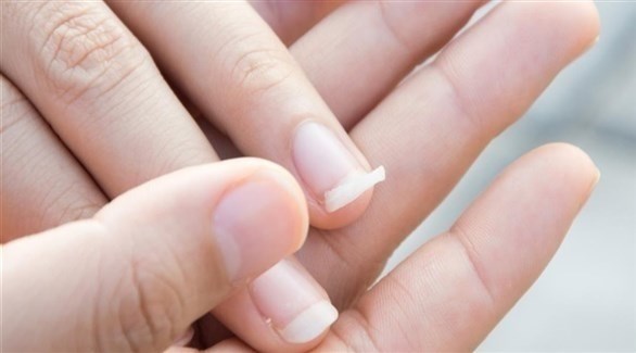 تقصف الأظافر قد ينذر بمشاكل صحية