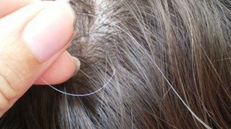 دراسة تكشف لماذا يشتعل ’الشيب‘ فجأة