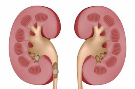 ستينية تخسر 15 كغم لإنقاذ حياة