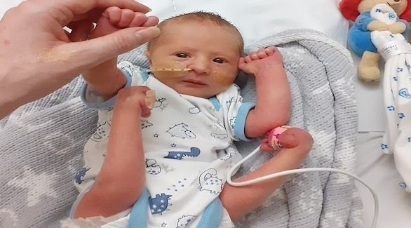 جنين يخضع لجراحة داخل رحم والدته