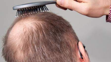 ما أسباب حكة فروة الرأس؟