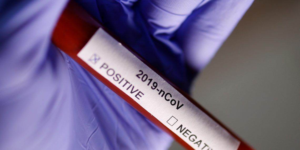 إسحق: الكورونا يبدأ بالانحسار عالميا نهاية