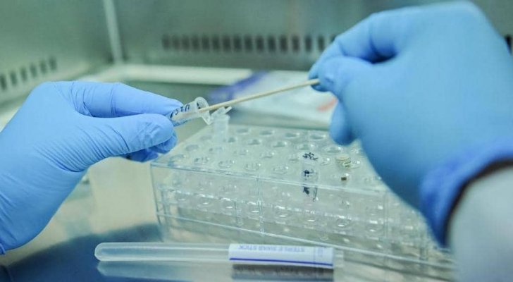 علماء يكتشفون فيروسا غامضا يدعى ’يارا‘