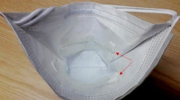 كمامة ثورية تكشف الإصابة بفيروس السل