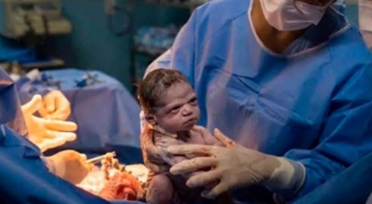 طفلة ولدت ’عاتبة‘ على الطبيب الذي