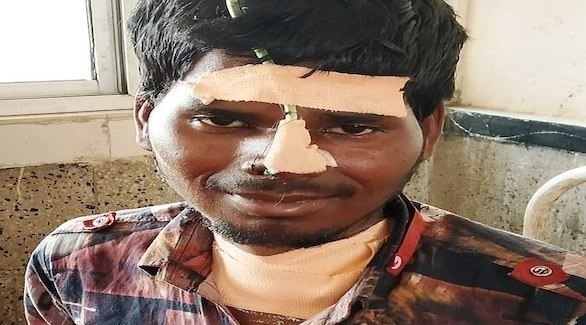 ابتلع قفلا في غفلة من عائلته..