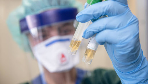 العلماء يكتشفون تغيرات في أعراض الإصابة