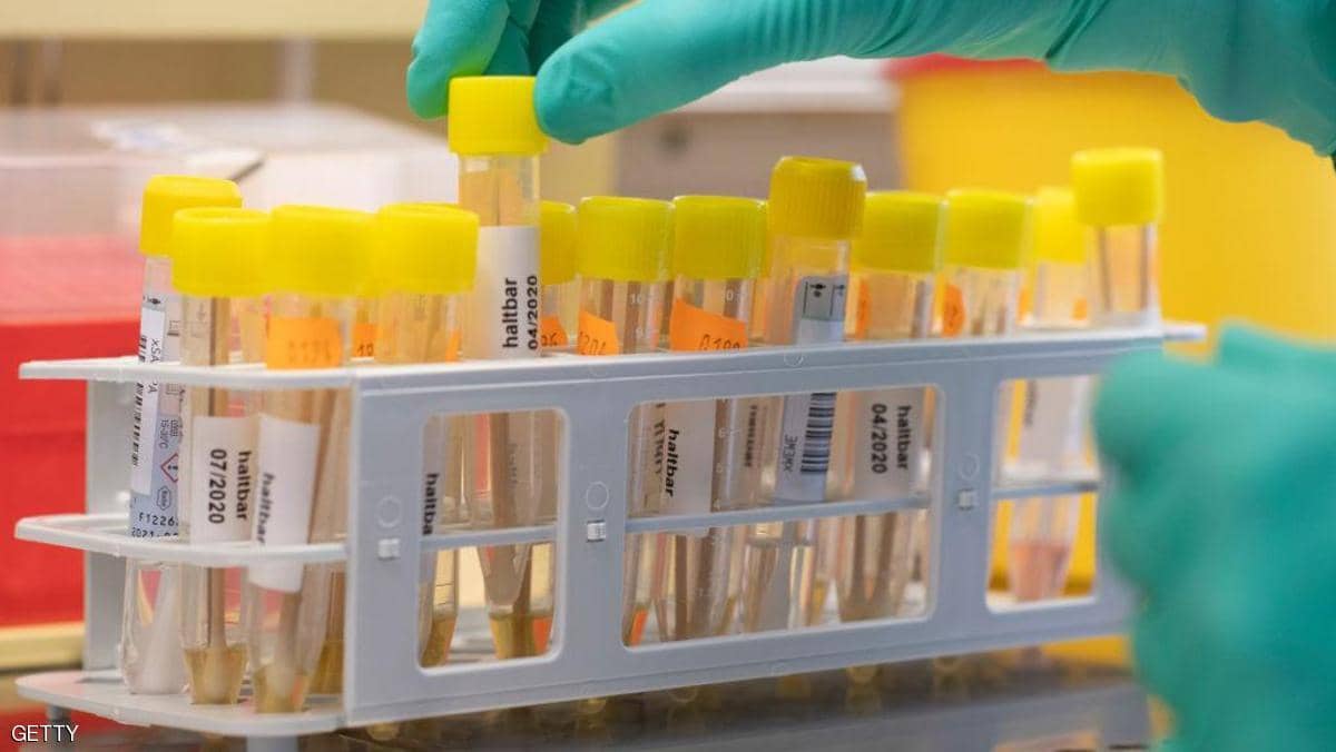 أخيرا.. دراسة «متفائلة» حول فيروس كورونا