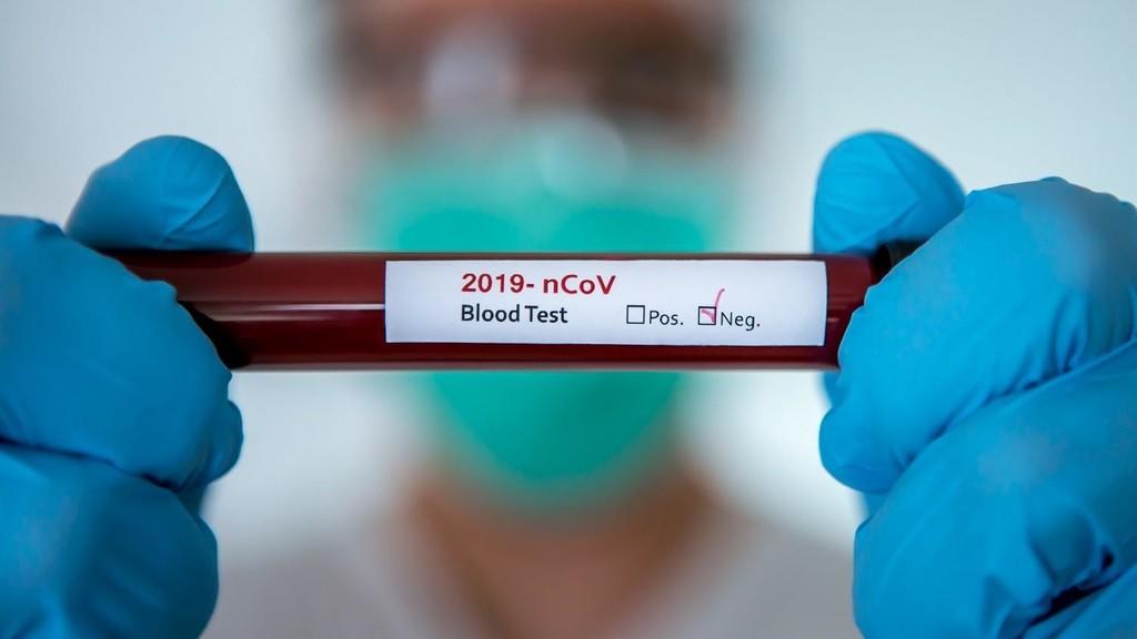 إجراء صورة طبقية أخيرة للمصاب بكورونا