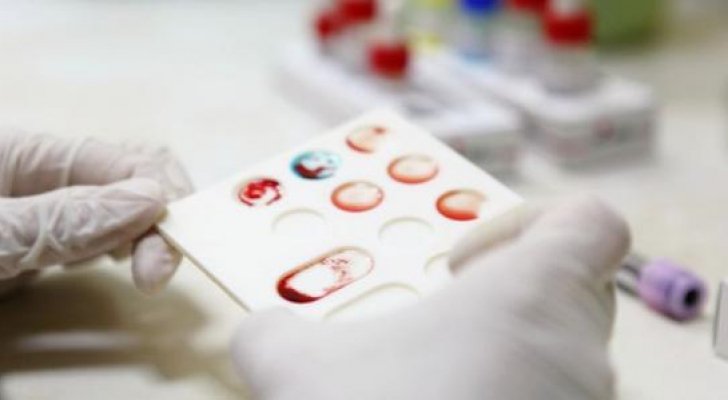 فحص طبي يكشف الإصابة بكورونا خلال