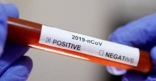 لجنة الأوبئة تعلق على بناية الهاشمي