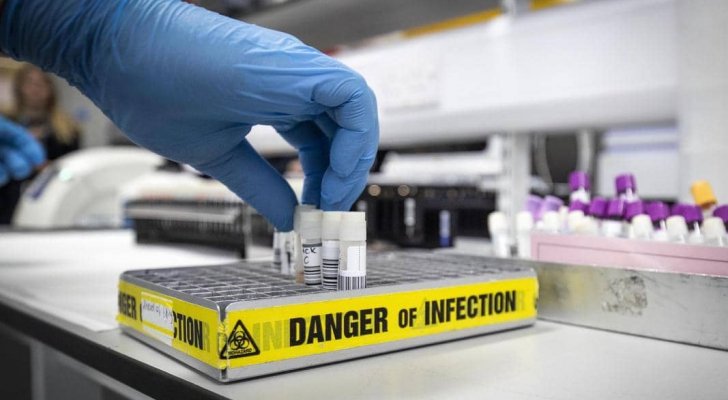 اختبار جديد يكشف الكثير عن كورونا