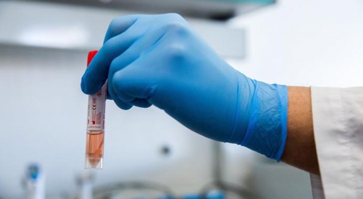 روسيا: علاج كورونا باستخدام العقار المضاد