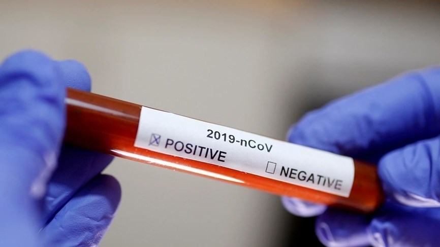 جمع 300 عينة لمخالطين في مناطق