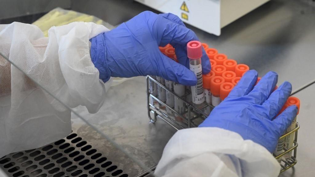 الوفاة الخامسة بكورونا من ضمن الحالات