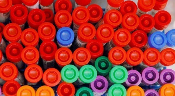 كورونا ومرضى السكري.. لماذا يظهر التأثير