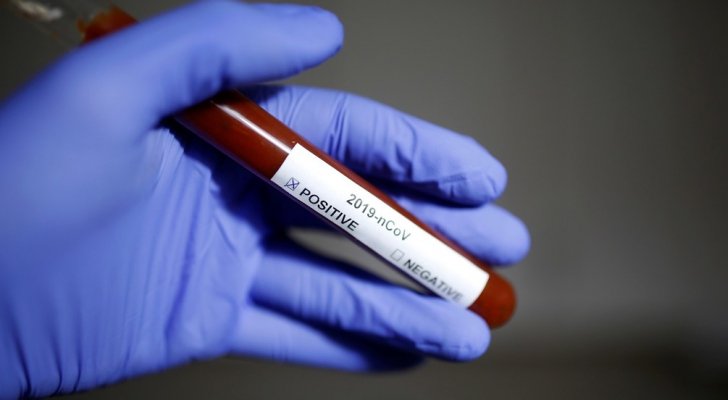 تسجيل 6 إصابات جديدة بفيروس كورونا