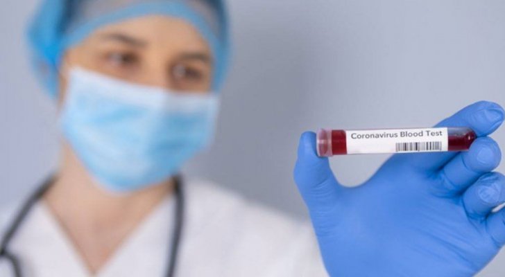 نتائج فحوصات نحو 100 عينة من