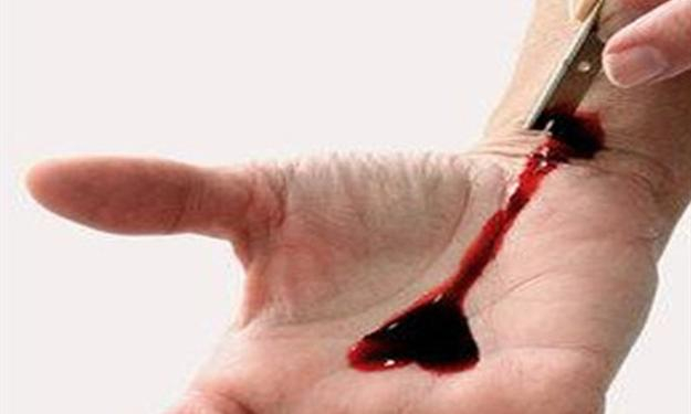 فتاة اردنية تقطع ’وريدها‘ محاولة الانتحار