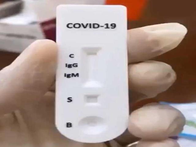 علماء: سلالة جديدة من كورونا أكثر