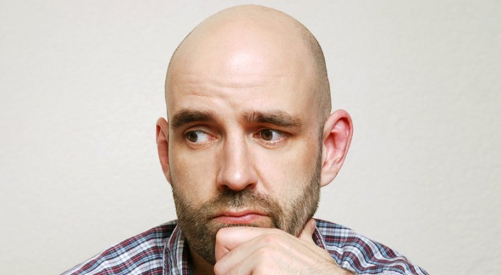 دراسة علمية: الرجال الصلع أكثر عرضة