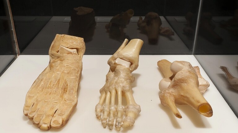 ابتكار ’أسمنت‘ لترميم شقوق العظام